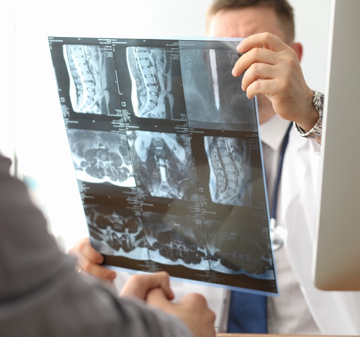 https://www.njspineandortho.com/wp-content/uploads/2022/03/Doctor-hold-xray-bone-spine-radiography-in-hand.jpg