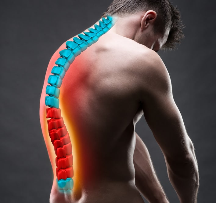 Kyphosis vs. Lordosis: What Are the Differences?
